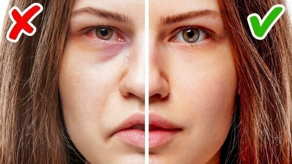Оличчя - Як зменшити набряклість обличчя?