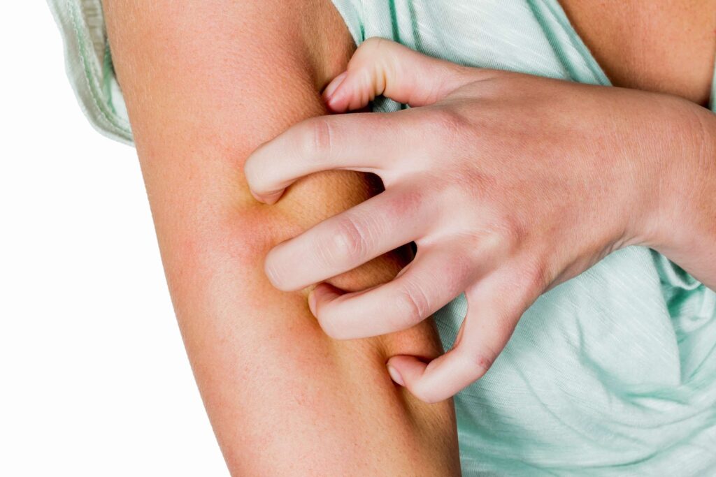 Ураження шкіри - Які симптоми, причини та лікування ураження шкіри?