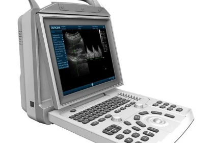 Чому портативний апарат УЗД — це новий стандарт мобільної діагностики?