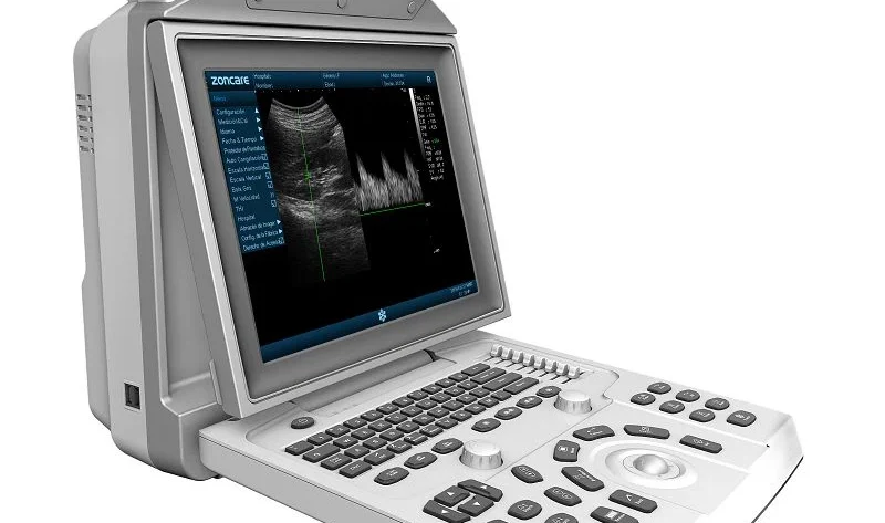 Чому портативний апарат УЗД — це новий стандарт мобільної діагностики?